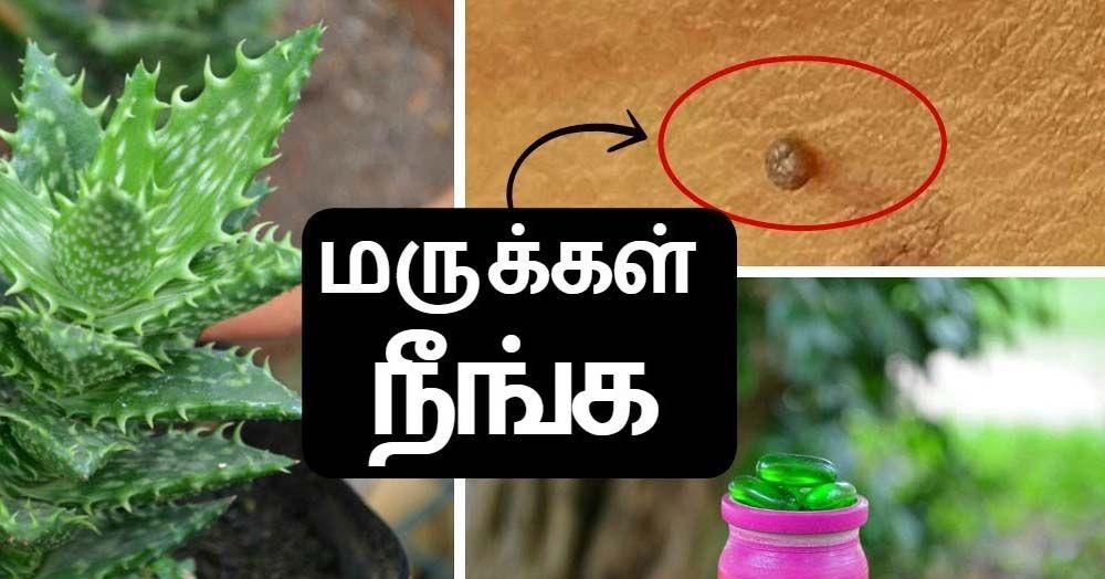 முகத்தில் இருக்கும் மருக்களை முற்றிலுமாக நீக்க சிறந்த முறைகள் &#8211; How To Remove Warts From Face And Neck In Tamil